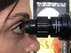 Бесконтактная коагуляция