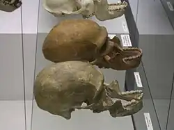 Черепа неандертальского человека и современного долихоцефала