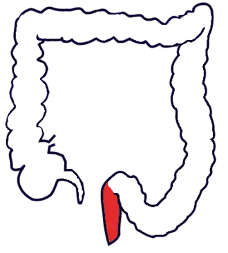 Прямая кишка толстого кишечника обозначена красным